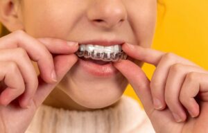 make O Teeth Aligner Treatment